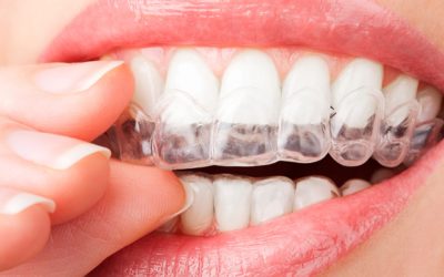 O que é Ortodontia?